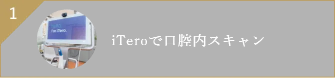 iTeroで口腔内スキャン