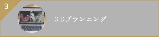 ３Dプランニング