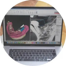 ３Dプランニング