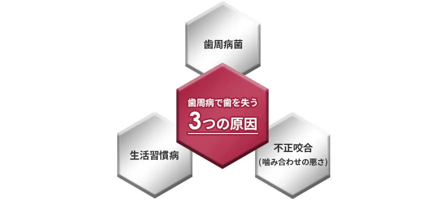 インプラント治療の意義
